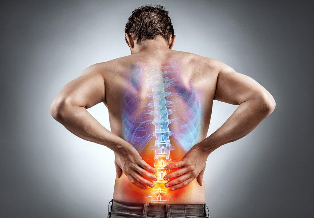 backache-1-1024x714